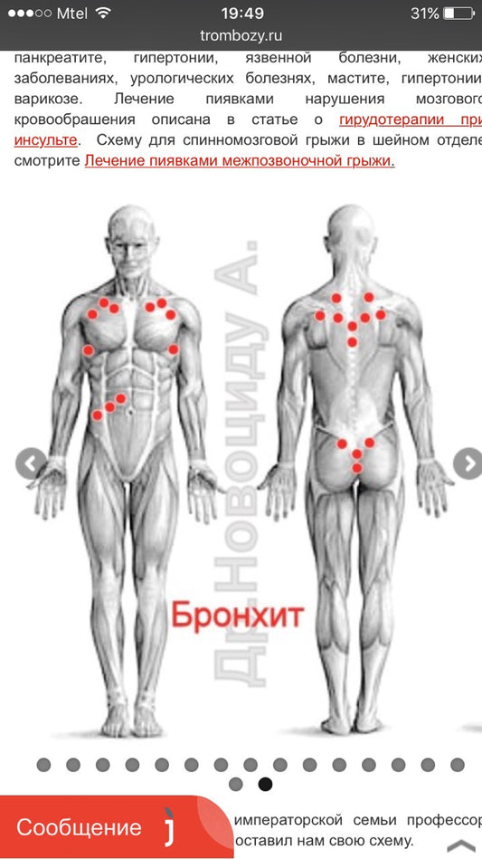 Медицински Пиявици в Хирудотерапията